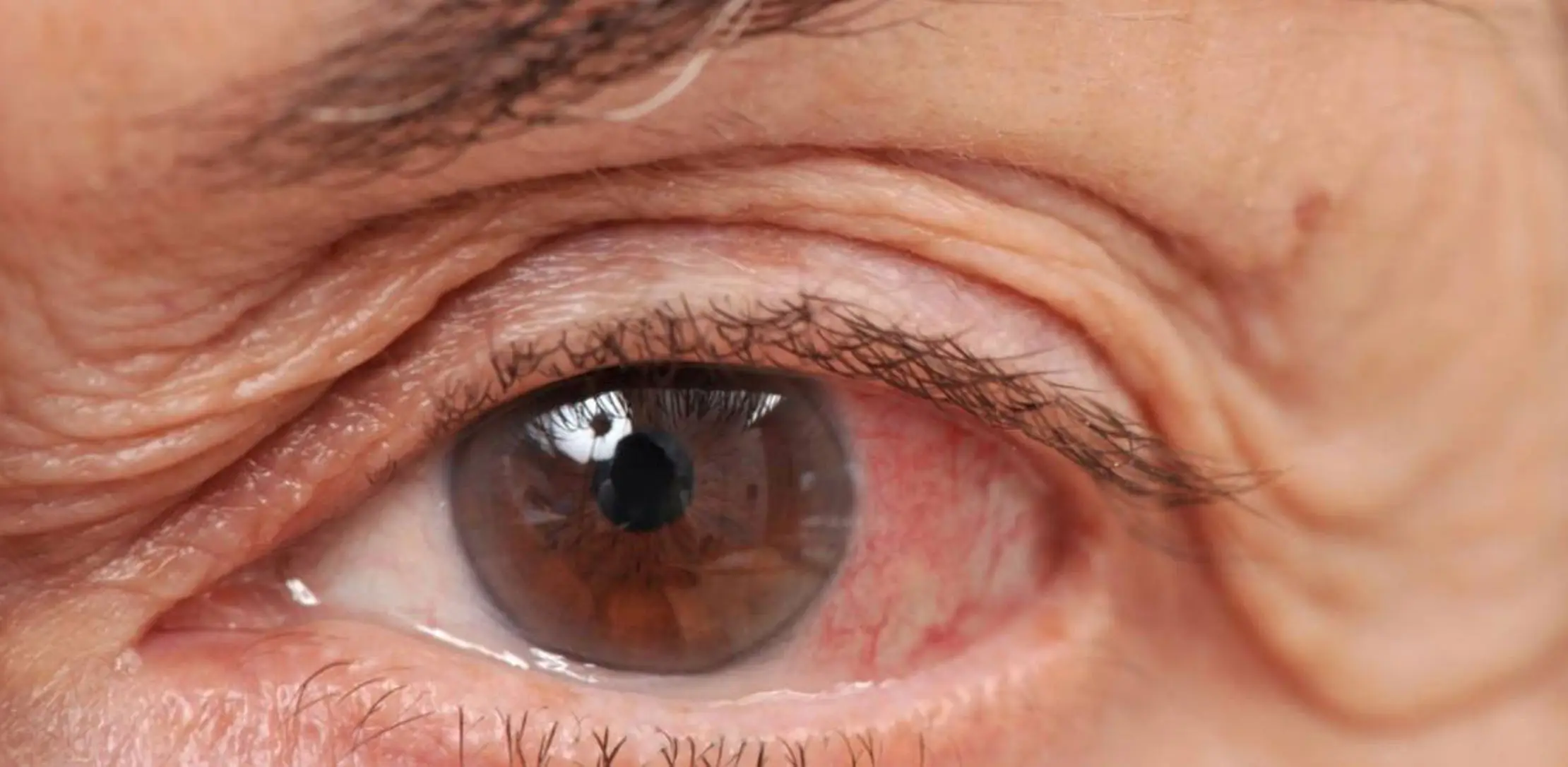 El Hospital Madariaga se suma a la campaña nacional de detección de Glaucoma