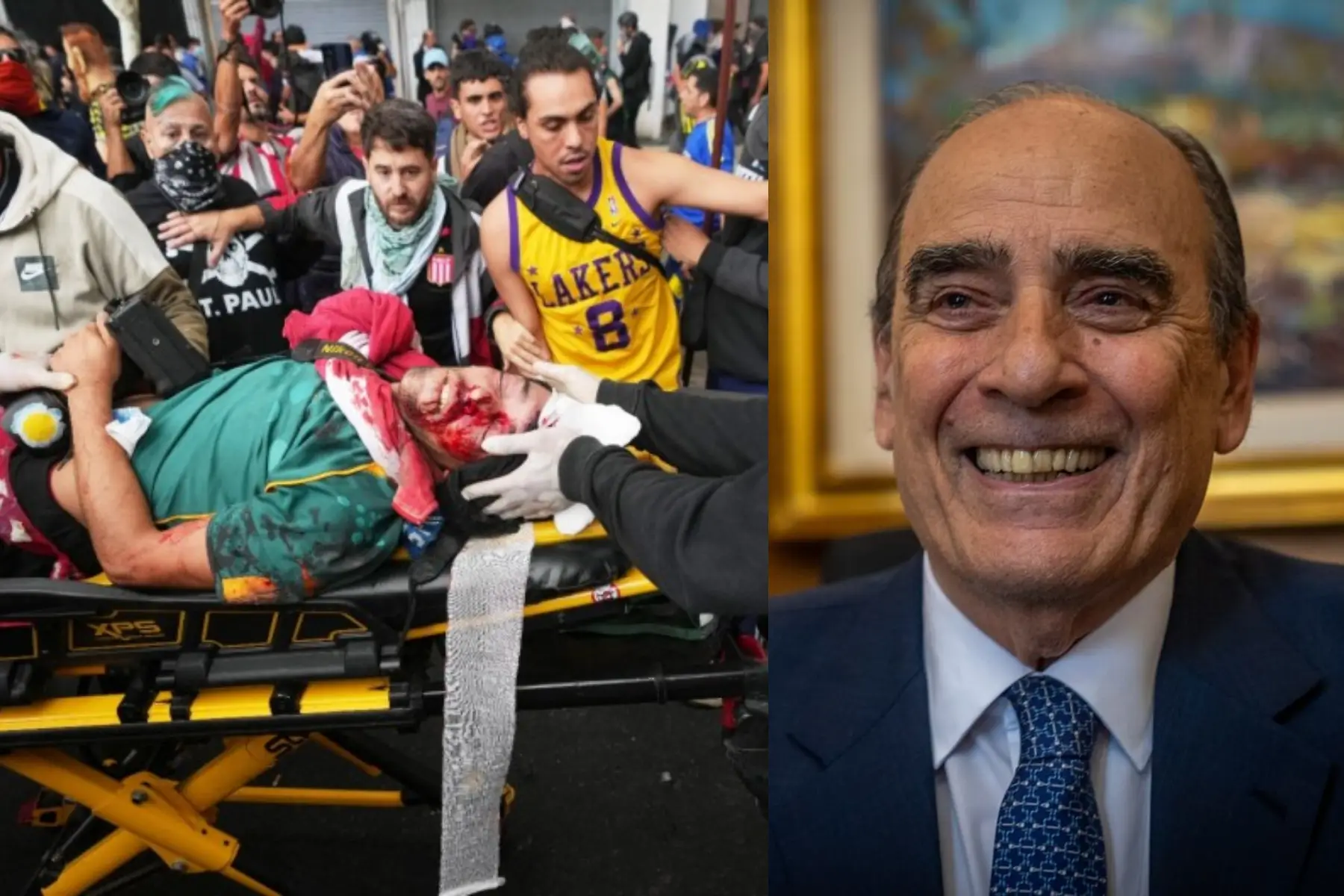 Francos minimizó el ataque criminal de la policía al fotógrafo en la marcha de jubilados