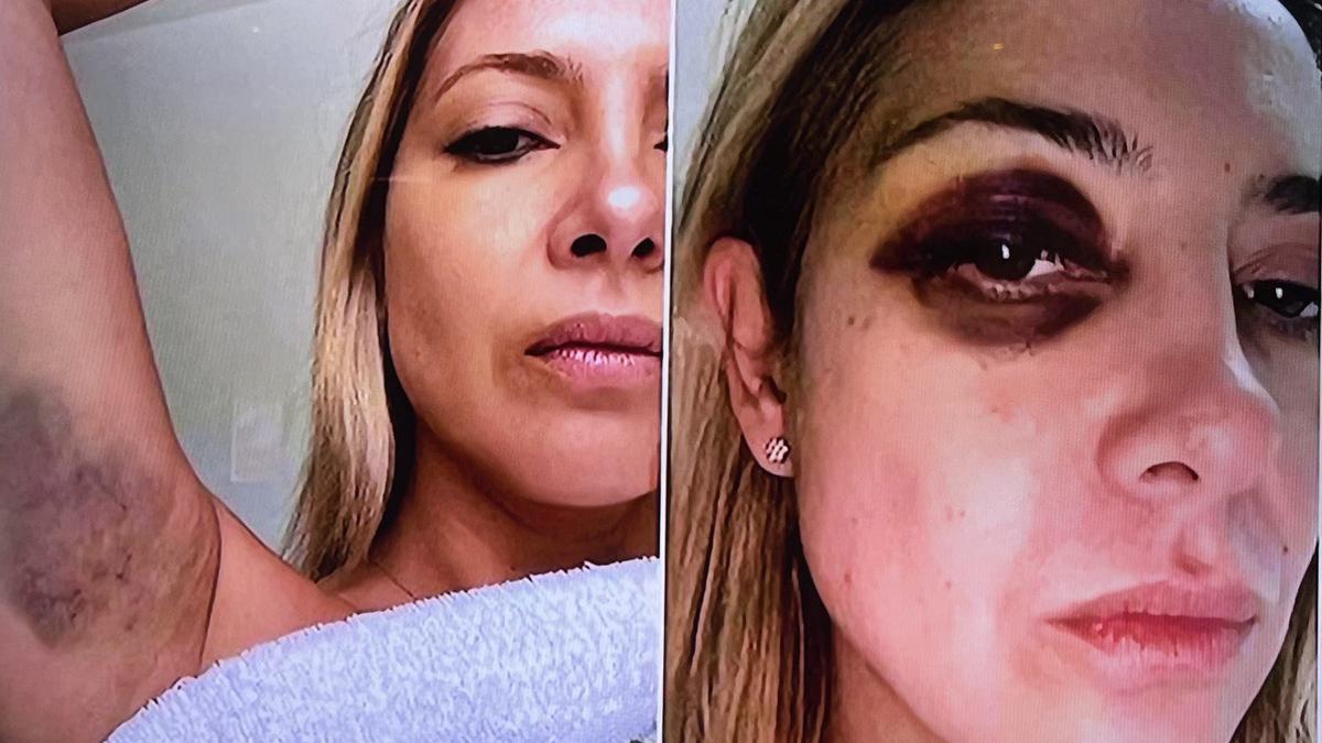 Escándalo: Difunden fotos de Fabiola Yáñez golpeada