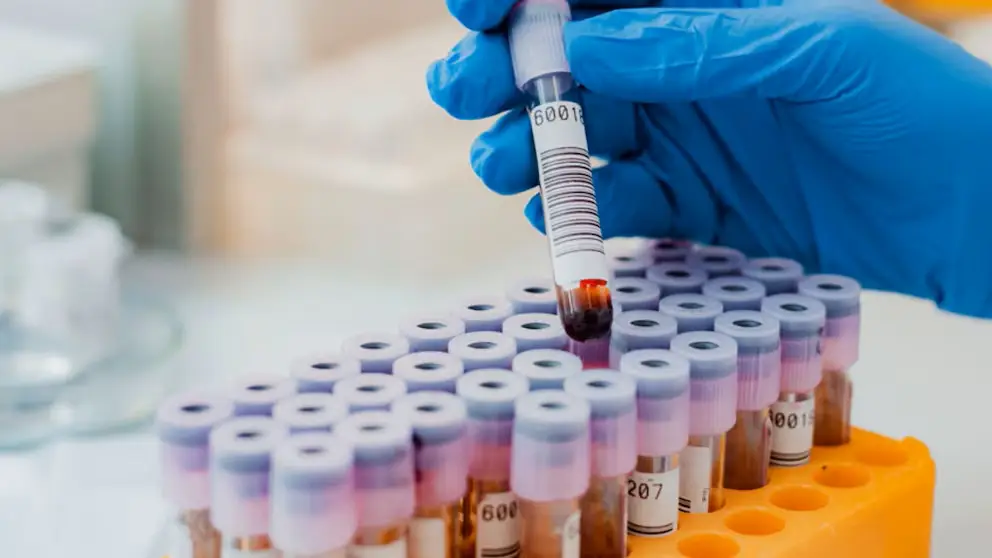 Qué tipo de sangre tiene más posibilidades a sufrir infartos